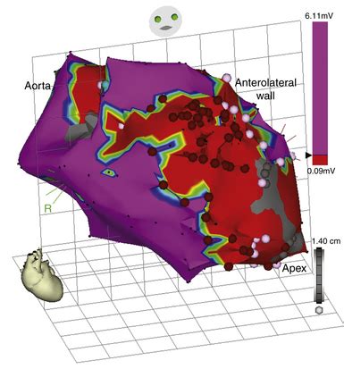 Advanced Mapping And Navigation Modalities Clinical Gate