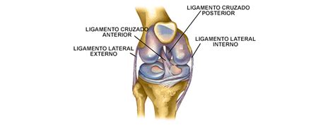 ¿qué Es La Rotura Del Ligamento Cruzado Anterior Kune Fisioterapia