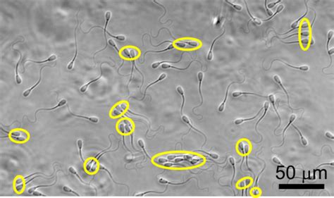 Bull Sperm Image Eurekalert Science News Releases