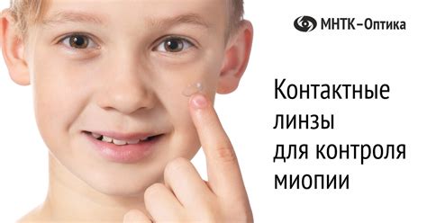 Контактные линзы для контроля миопии — МНТК-Оптика