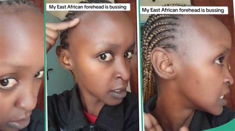 Even A Wig Cannot Fit Lady Shows Her Unique Forehead With No Hair Video Goes Viral Legit Ng