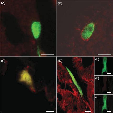 Localization Of Enhanced Green Fluorescent Protein Expressing Human