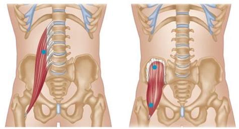 Trigger Point Therapy - Treating Psoas | Psoas muscle, Trigger points ...