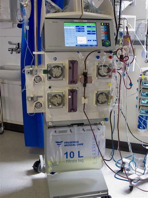 Kidney Dialysis Machine Use at Ryan Henderson blog