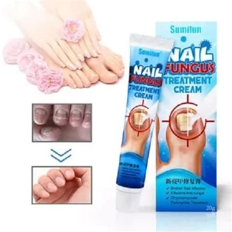 Sumifun Nail Fungus Treatment Cream 20g Konga Online Shopping