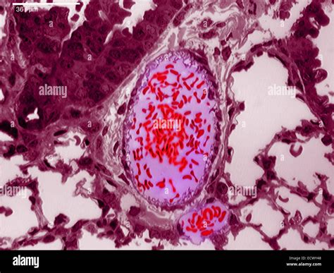 Light Microscope Image Of Mouse Lung Cells Stock Photo Alamy