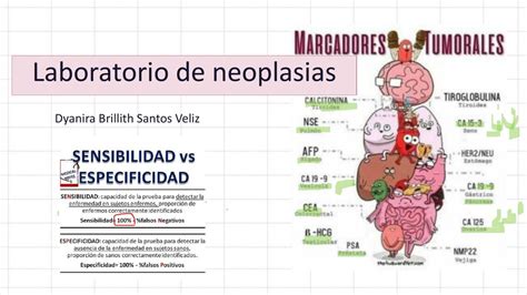 Laboratorio Marcadores Tumorales Dyanira Brillith Santos Veliz UDocz