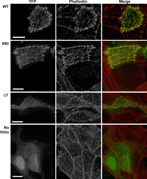 Wt And Rri Villin Have The Same Localization And Morphogenic Effects In