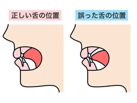 mft