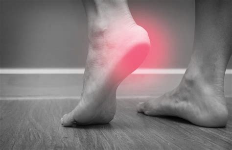 How To Increase Your Va Rating For Plantar Fasciitis