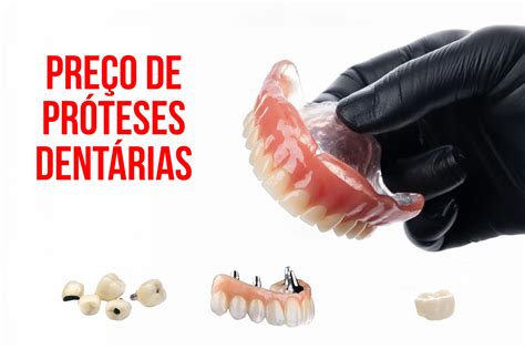 Qual O Valor De Uma Prótese Fixa - prótese dental | Ciotti Odontologia