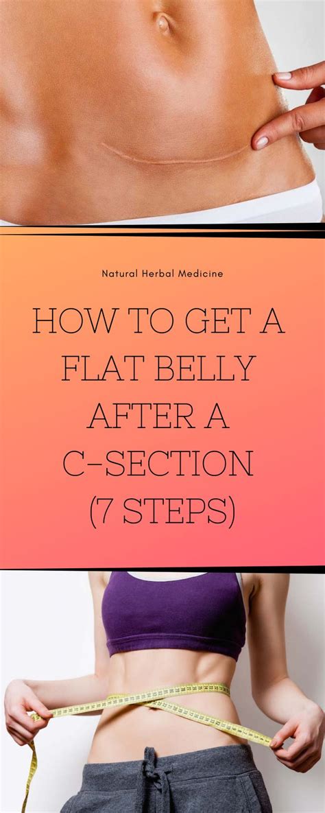 Awasome How To Get Rid Of Hanging Belly After C Section Youtube Ideas