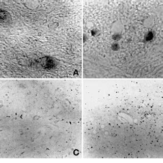 Representative Photomicrographs Showing Axonal And Neuronal