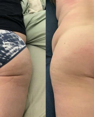 Belly Betty Reveals Dressed Undressed Panties Nude Gainer Porn Pictures Xxx Photos Sex Images