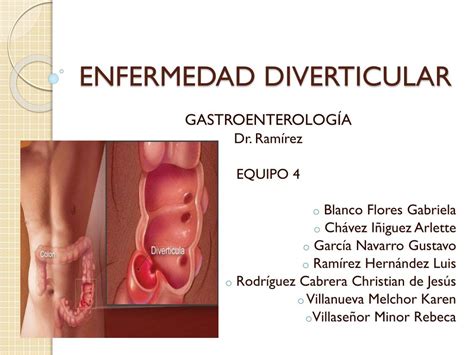 Ppt Enfermedad Diverticular Powerpoint Presentation Free Download