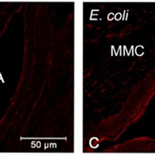 Representative pictures show calcitonin receptor-like receptor ...