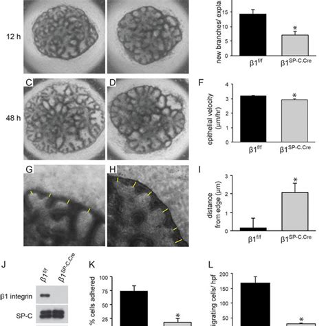 Deleting β1 integrin in lung epithelium causes adhesion and migration