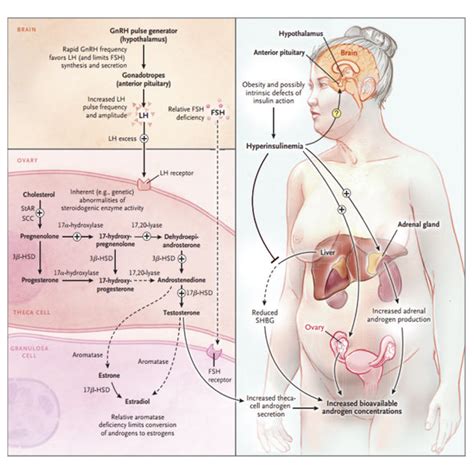 Pdf Association Of Insulin Resistance And Elevated Androgen Levels