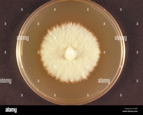 Top View Of A Sabouraud Dextrose Agar Plate Culture Growing The