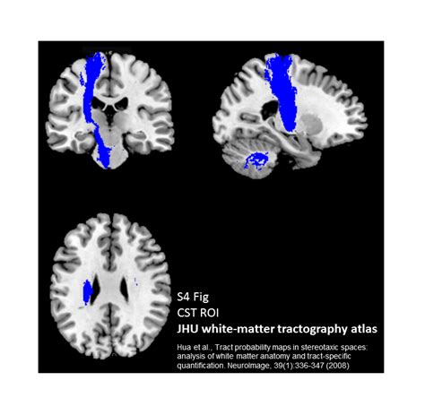 Whole Brain White Matter Microstructure And Upper Limb Function