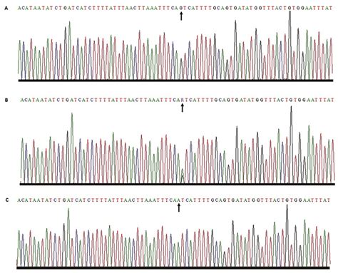 Sequence analysis of the splice site mutation identified in 4 families ...