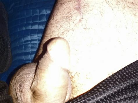 Circumcised Cock Relaxing 5 Nude Pics XHamster