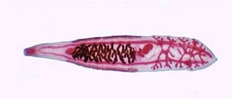 Parasitology Exam 3 Pictures Flashcards Quizlet