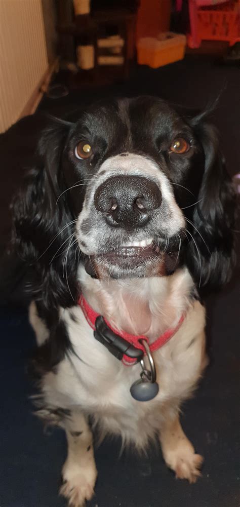 Understanding the Causes and Solutions for a Right-Side Lip Twitch 27