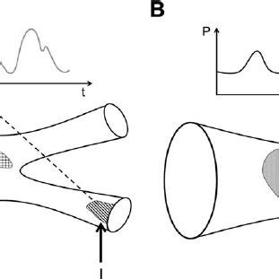 ¤ Schematic depictions of a bifurcated endograft with ( A ) types I and ...