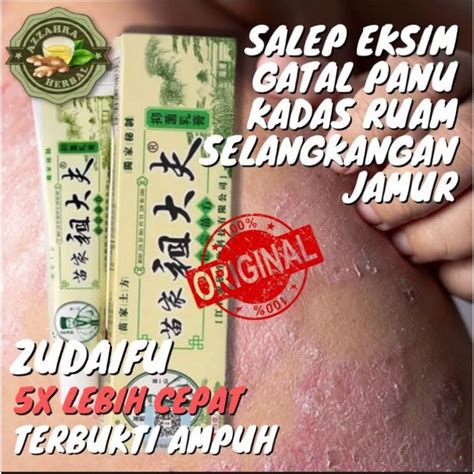 Jual Ampuh Salep Gatal Kudis Jamur Panu Ruam Eksim Salep Penghilang