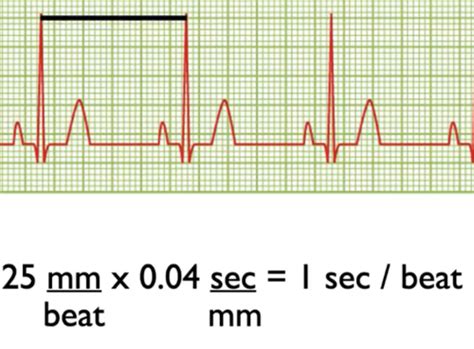 ecg calculations flashcards quizlet