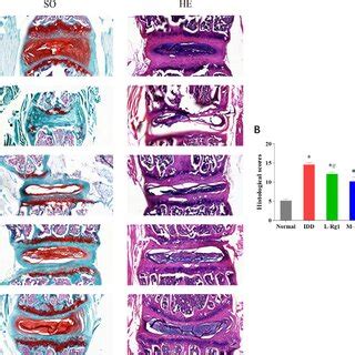 Effect Of Ginsenoside Rg1 On Pathology Of Nucleus Pulposus Tissues In