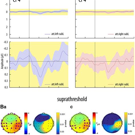 Subthreshold A And Suprathreshold B Isocontour Voltage Maps And