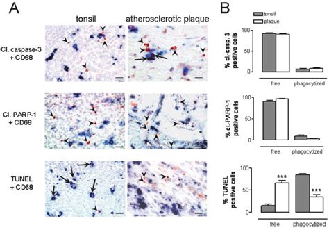 Figure 1 from Comparison of Apoptosis Detection Markers Combined with ...