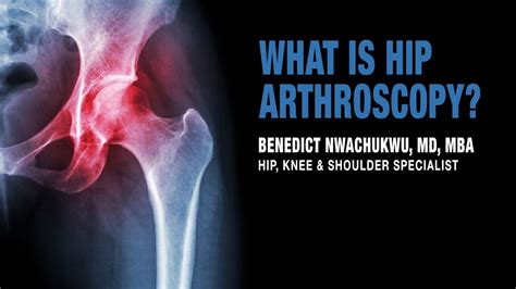 What Is Hip Arthroscopy Hip Surgery Recovery Pain Management