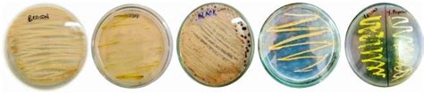 Pure Isolated Colonies Of Actinomycetes On Starch Nitrate Agar Brown