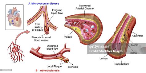 Blood Vessel Anatomy High-Res Vector Graphic - Getty Images