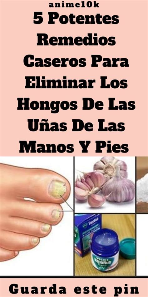 5 Potentes Remedios Caseros Para Eliminar Los Hongos De Las Uñas De Las Manos Y Pies Tu Salud