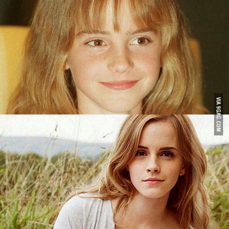 Emma Watson Before And After Puberty Emma Watson Boob Job And Other