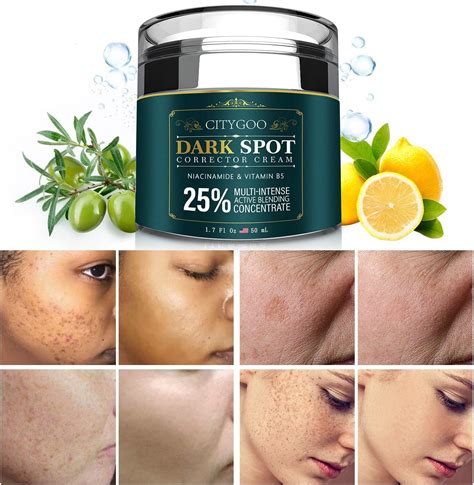 Amazon Citygoo Dark Spot Remover For Face And Body Corrector