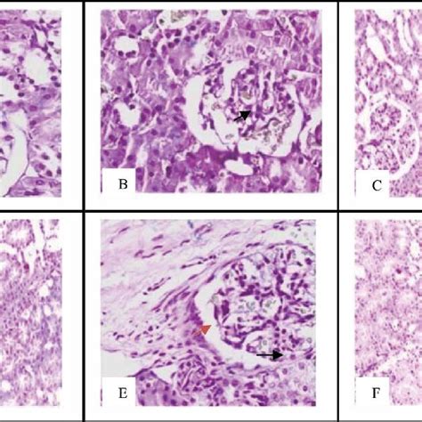 Histological Sections Of Rat Liver From Different Groups H And E X