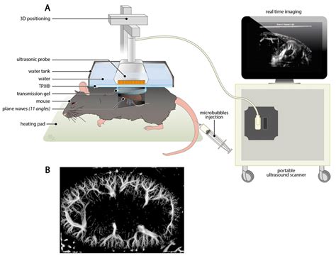 Ultrafast Doppler Ultrasound Imaging Of The Kidney Is A Highly