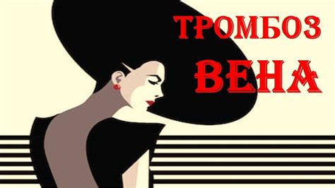 Варикозное расширение вен Причины Симптомы Лечение Профилактика - YouTube