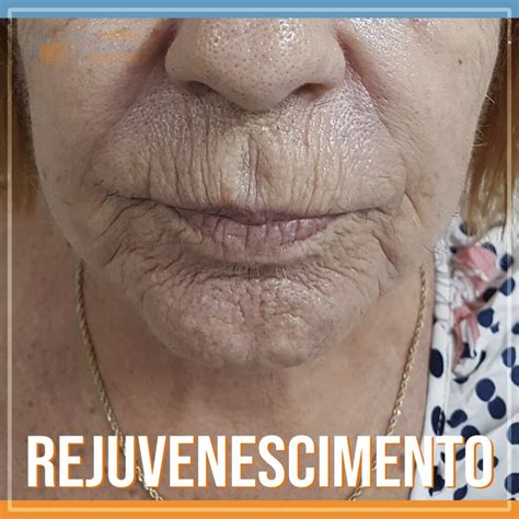 O Que E Rejuvenescer - Como Rejuvenescer A Pele - Clínica De Pele | Dermatologia & Estética 2026