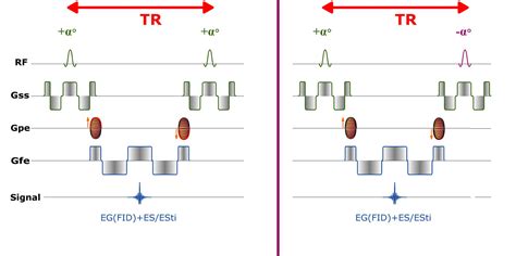 Mri Sequences Balanced Gradient Echo E Mri