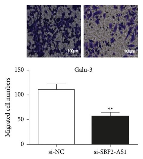 Sbf2 As1 Knockdown Repressed Cell Proliferation Invasion And