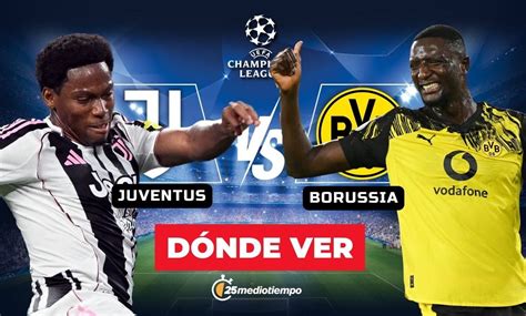 Estatísticas De Juventus X Borussia - Juventus vs. Borussia: dónde y a qué hora ver EN VIVO Champions League