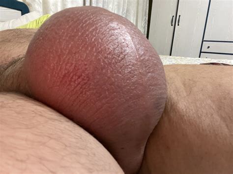 My Saline Balls 20 Nude Pics XHamster