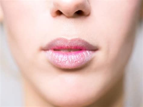 Dry And Chapped Lips Are Troubling You So Try These Tips To Get Relief Soon गर्मी में धूप की