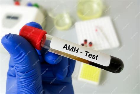 premium photo amh anti mullerian hormone test ovarian function